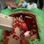 Surgeon Simulator Sells +2 Million Copies in Lifetime